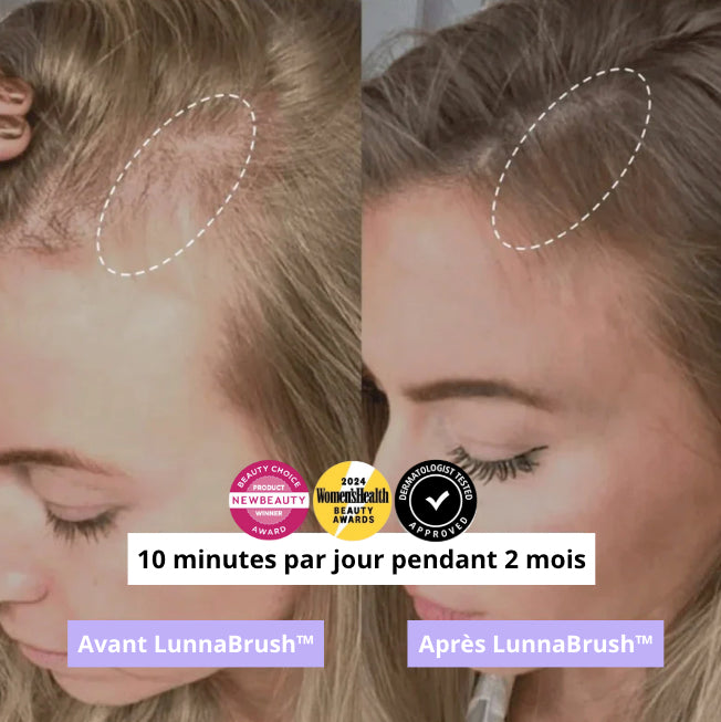 Lunna™ - solution avancée contre la perte de cheveux