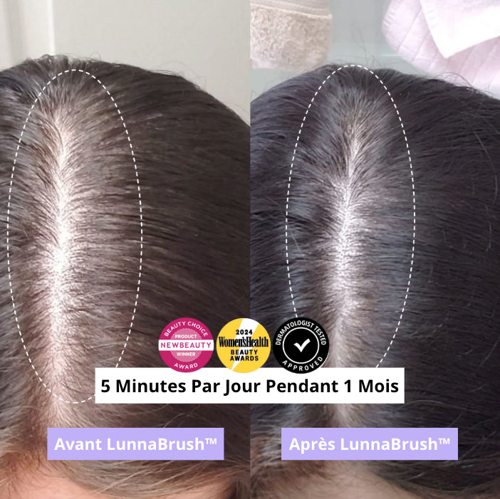 Lunna™ - solution avancée contre la perte de cheveux